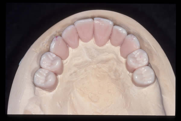 Occlusal and TMD treatments