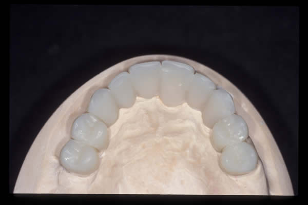 Occlusal and TMD treatments