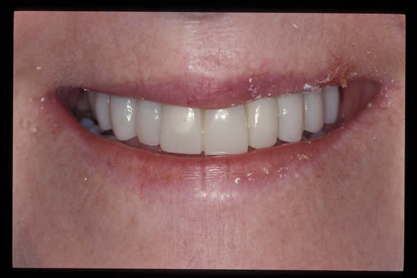 Occlusal and TMD treatments