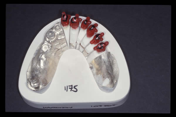 Occlusal and TMD treatments