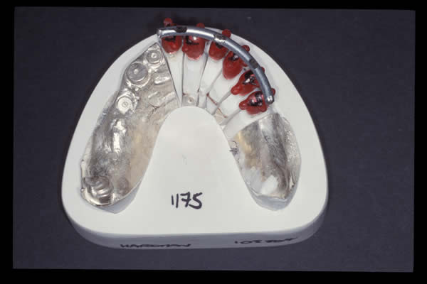 Occlusal and TMD treatments